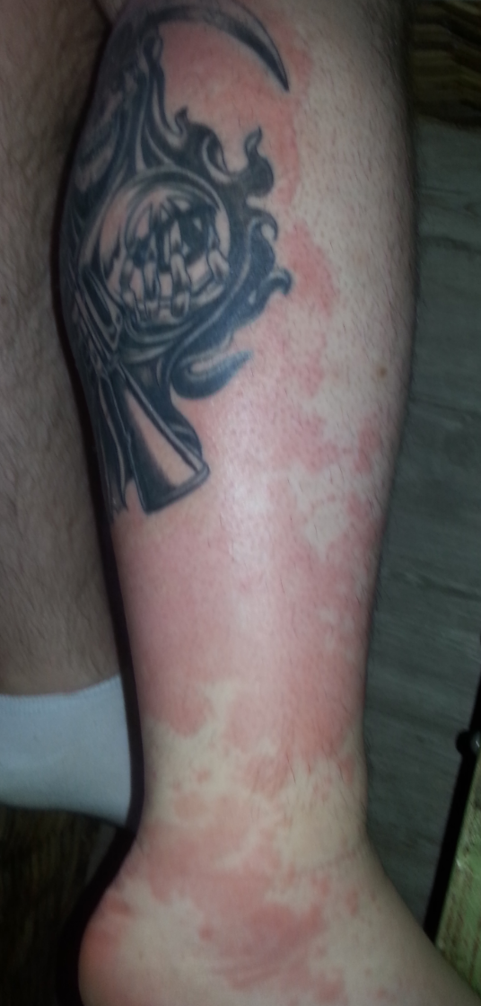 Kontaktallergie gegen Bepanthen? Tattoo Bewertung.de